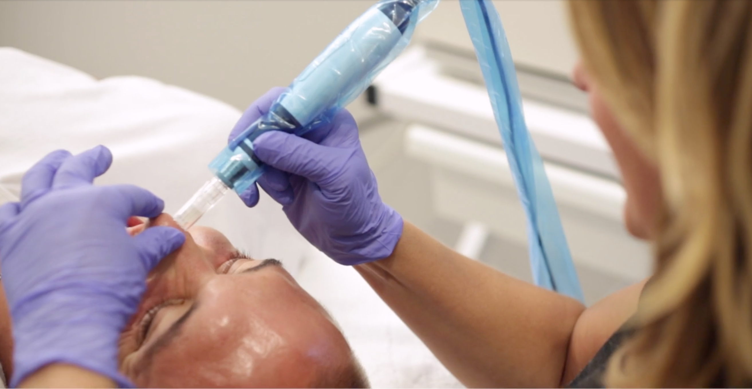 Our Journey to Wellness: Buck tries Rejuvapen